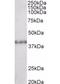 Suppressor Of Variegation 3-9 Homolog 2 antibody, orb18581, Biorbyt, Western Blot image 