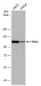 Protein Tyrosine Kinase 2 Beta antibody, GTX634162, GeneTex, Western Blot image 