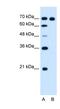 Ribonucleotide Reductase Catalytic Subunit M1 antibody, NBP1-58069, Novus Biologicals, Western Blot image 