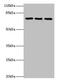 Zinc Finger Protein 699 antibody, CSB-PA026960LA01HU, Cusabio, Western Blot image 