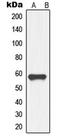 Growth Differentiation Factor 9 antibody, LS-C352241, Lifespan Biosciences, Western Blot image 