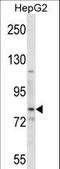 Smoothened, Frizzled Class Receptor antibody, LS-C161317, Lifespan Biosciences, Western Blot image 