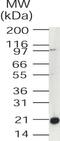 Ubiquitin Conjugating Enzyme E2 V1 antibody, PA1-41381, Invitrogen Antibodies, Western Blot image 