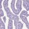 Dynein Axonemal Heavy Chain 11 antibody, HPA056474, Atlas Antibodies, Immunohistochemistry paraffin image 