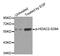 Histone Deacetylase 2 antibody, STJ22164, St John