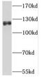 Thyroid Hormone Receptor Associated Protein 3 antibody, FNab08673, FineTest, Western Blot image 