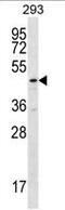 Tubulin Folding Cofactor E Like antibody, AP54179PU-N, Origene, Western Blot image 