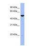 Mitogen-Activated Protein Kinase Kinase 7 antibody, NBP1-55001, Novus Biologicals, Western Blot image 