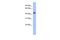 Cytochrome P450 Family 20 Subfamily A Member 1 antibody, GTX44873, GeneTex, Western Blot image 