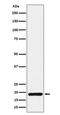 Thioredoxin Domain Containing 12 antibody, M08975, Boster Biological Technology, Western Blot image 