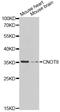 CCR4-NOT Transcription Complex Subunit 8 antibody, STJ110361, St John