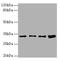 General Transcription Factor IIE Subunit 2 antibody, A53643-100, Epigentek, Western Blot image 
