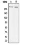 Myosin VIIA antibody, LS-B13642, Lifespan Biosciences, Western Blot image 