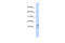 Interleukin 15 antibody, ARP55616_P050, Aviva Systems Biology, Western Blot image 