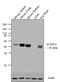 Intercellular Adhesion Molecule 1 antibody, MA5407, Invitrogen Antibodies, Western Blot image 