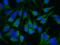 ADAM Metallopeptidase Domain 15 antibody, GTX02007, GeneTex, Immunocytochemistry image 