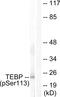 Prostaglandin E Synthase 3 antibody, PA5-38337, Invitrogen Antibodies, Western Blot image 