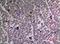 Ubiquitination Factor E4A antibody, A11871, Boster Biological Technology, Immunohistochemistry paraffin image 