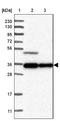 Tetratricopeptide Repeat Domain 23 Like antibody, NBP1-83559, Novus Biologicals, Western Blot image 