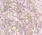 Tyrosinase antibody, NBP2-67232, Novus Biologicals, Immunohistochemistry paraffin image 