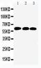 SMAD Family Member 4 antibody, PA1953, Boster Biological Technology, Western Blot image 