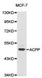 Acid Phosphatase, Prostate antibody, A02082-1, Boster Biological Technology, Western Blot image 