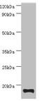 Troponin C2, Fast Skeletal Type antibody, MBS1496004, MyBioSource, Western Blot image 