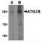 Autophagy Related 2B antibody, MBS151237, MyBioSource, Western Blot image 