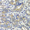 4-Aminobutyrate Aminotransferase antibody, A5299, ABclonal Technology, Immunohistochemistry paraffin image 