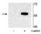 Tryptophan Hydroxylase 2 antibody, P01643, Boster Biological Technology, Western Blot image 