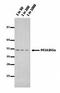 Protein Phosphatase 2 Regulatory Subunit Balpha antibody, orb76778, Biorbyt, Western Blot image 