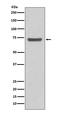 ATP Binding Cassette Subfamily G Member 2 (Junior Blood Group) antibody, M00457, Boster Biological Technology, Western Blot image 