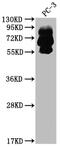Proprotein Convertase Subtilisin/Kexin Type 9 antibody, CSB-RA259644A0HU, Cusabio, Western Blot image 