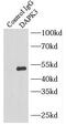 ZIPK antibody, FNab09644, FineTest, Immunoprecipitation image 