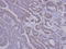 Sorting Nexin 12 antibody, LS-C185814, Lifespan Biosciences, Immunohistochemistry frozen image 