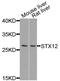 Syntaxin 12 antibody, orb374000, Biorbyt, Western Blot image 