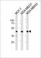 Sarcoglycan Gamma antibody, PA5-35288, Invitrogen Antibodies, Western Blot image 