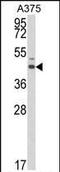 Steroid hormone receptor ERR1 antibody, PA5-35348, Invitrogen Antibodies, Western Blot image 