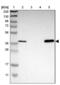 Metallophosphoesterase 1 antibody, NBP1-86089, Novus Biologicals, Western Blot image 