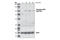 Receptor Interacting Serine/Threonine Kinase 2 antibody, 4364S, Cell Signaling Technology, Western Blot image 