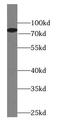 Histidine Ammonia-Lyase antibody, FNab03750, FineTest, Western Blot image 