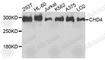 Chromodomain Helicase DNA Binding Protein 4 antibody, A9904, ABclonal Technology, Western Blot image 