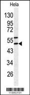 Serpin Family H Member 1 antibody, MBS9212684, MyBioSource, Western Blot image 