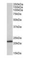 Transmembrane Protein 205 antibody, orb125084, Biorbyt, Western Blot image 