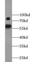 YY1 Associated Protein 1 antibody, FNab09579, FineTest, Western Blot image 