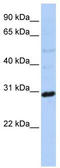 Metaxin 2 antibody, TA339944, Origene, Western Blot image 