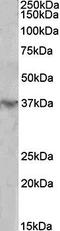 Homeobox D12 antibody, orb79355, Biorbyt, Western Blot image 