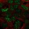 Scm-like with four MBT domains protein 2 antibody, HPA035447, Atlas Antibodies, Immunocytochemistry image 