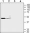 Solute Carrier Family 2 Member 2 antibody, PA5-77459, Invitrogen Antibodies, Western Blot image 