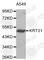 Hair keratin, type I Ha1 antibody, A2663, ABclonal Technology, Western Blot image 